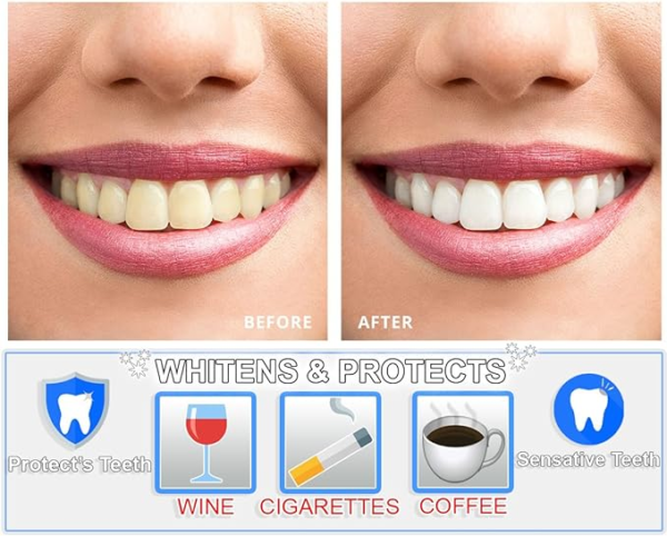 BLANQUEADOR DE DIENTES – ¡SONRÍE CON CONFIANZA! - TEETH WHITENING - Imagen 3